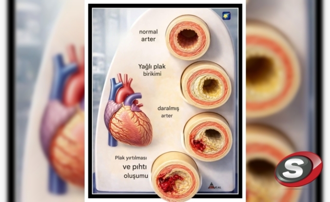 Kardiyolog Ali Erdoğan’dan Hayati Uyarı: Kalp Damarlarınız Sessizce Tıkanıyor Olabilir!